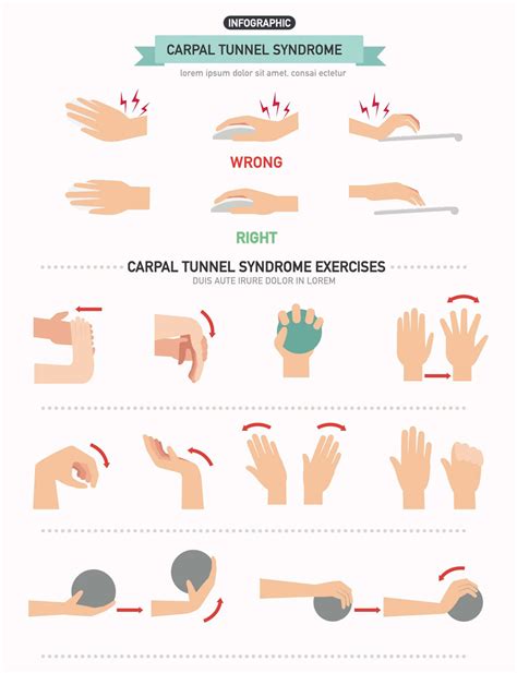 Therapy Exercises For Carpal Tunnel Syndrome at Harry Stedman blog