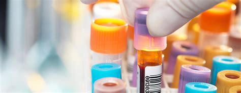 Uric acid - blood