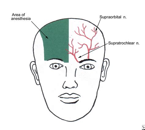 Wiki - supraorbital nerve blocks | Medical Billing and Coding Forum - AAPC