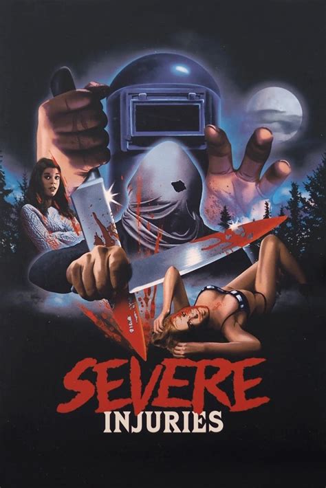 Severe Injuries - posters, covers, wallpapers — ACMODASI India