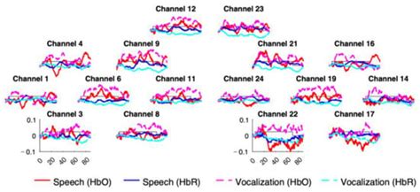 A Within-Subject Multimodal NIRS-EEG Classifier for Infant Data
