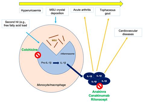 Uric Acid, Colchicine and Chronic Inflammatory Diseases: A ...