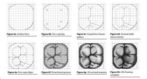 Carabelli Cusp Mandibular
