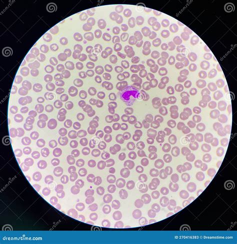 Neutrophil Band Form on Rbc Background Stock Image - Image of ...