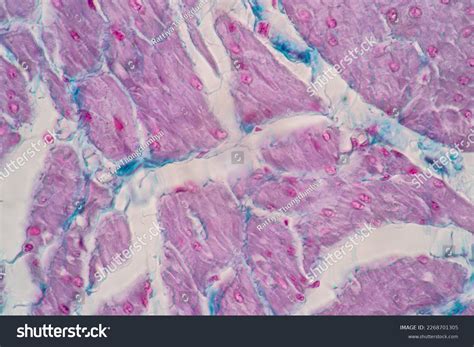 Smooth Muscle Under Microscope Labeled