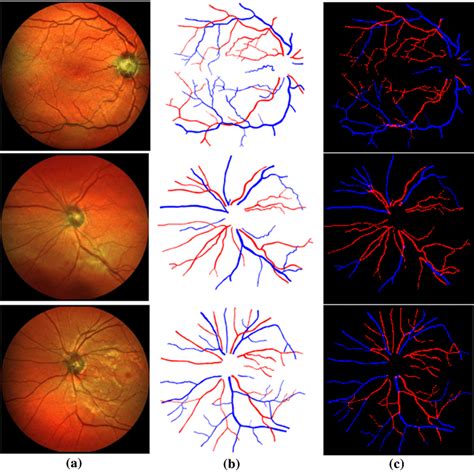 Image result for Channel AV Classification