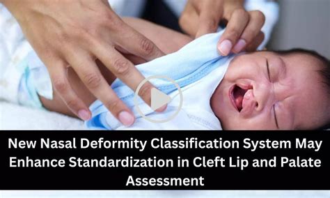New Nasal Deformity Classification System May Enhance Standardization ...
