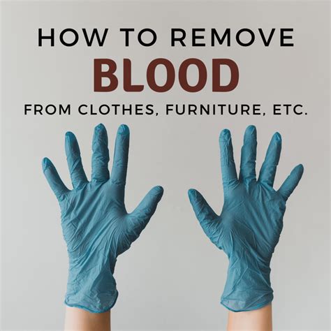 What The Best Way To Remove Blood Stains From Clothing at Janine Hall blog