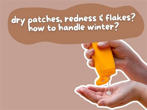 Why Children Get Dry Skin in Winter: How to Prevent Dry Patches ...