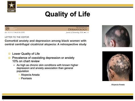 AR 670-1: Army Leaders to Announce Hair Regulation Changes in 2021