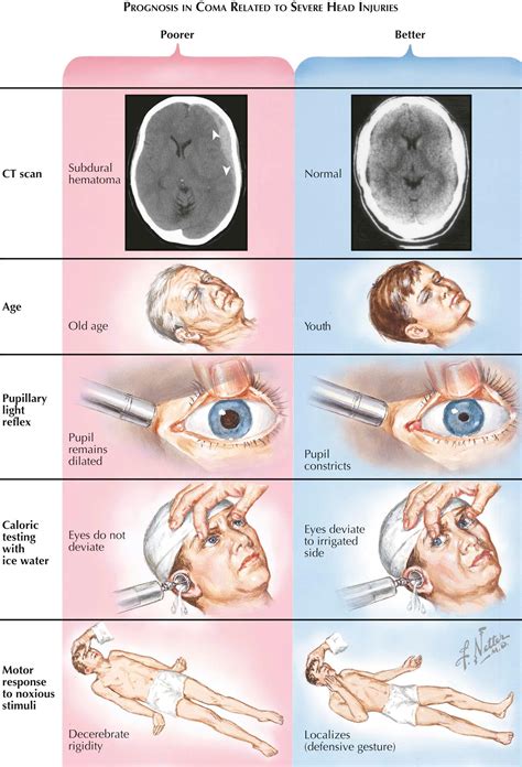 Disorders of Consciousness (Coma) - Clinical Tree