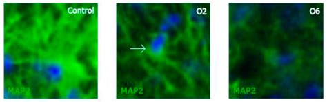 The Neurotoxic Effect of Ochratoxin-A on the Hippocampal Neurogenic ...