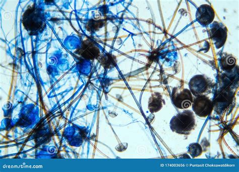 Rhizopus Bread Mold Under the Microscope Stock Photo - Image of ...