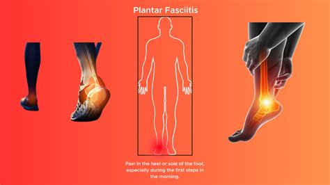 Know Your Pain – The Pain Company