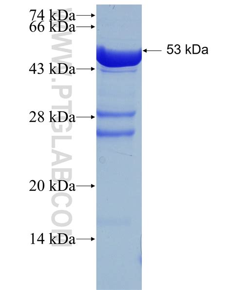 RABIN8 Fusion Protein Ag2974 | Proteintech
