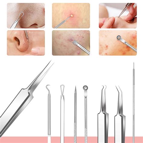 Best Blackhead Removal Videos