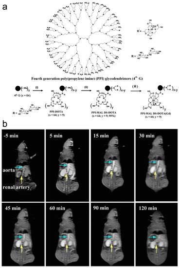 The Renal Clearable Magnetic Resonance Imaging Contrast Agents: State ...