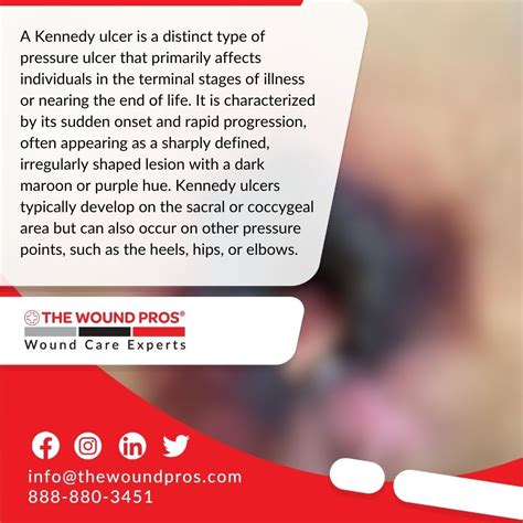 The Wound Pros LLC on LinkedIn: #woundcare #kennedyulcers #pressureulcers #woundhealing…