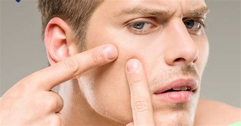 Image result for Exploding Pimples 2017