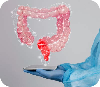 Image result for Exploding Colon