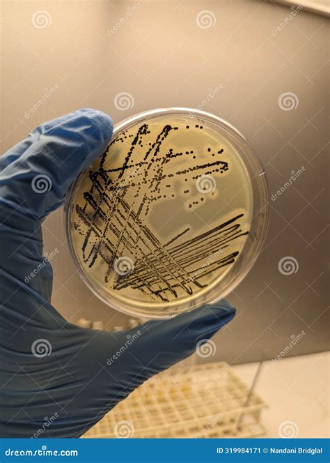 Quadrant Streak of Staphylococcus Aureus on Baird Parker Agar Plate ...