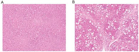 Effect of Hepatic Impairment on the Pharmacokinetics of Baicalin in ...