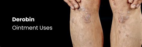 Derobin Ointment: Uses and Application Guide