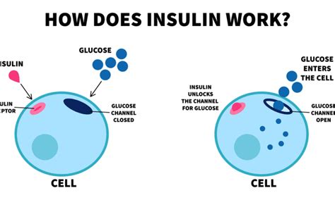 Image result for Insulin Management Algorithm