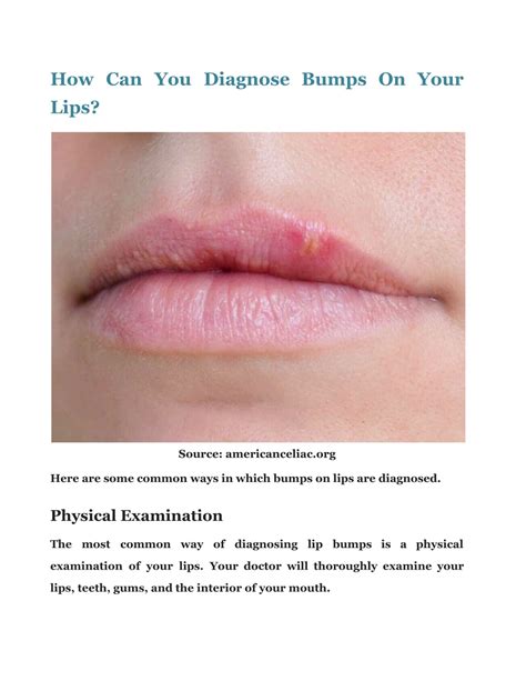 PPT - Bump On Lip: Check Out The Causes And Its Treatment PowerPoint ...