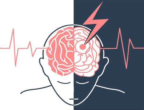Newsband - World Stroke Day: Warning signs everyone should know