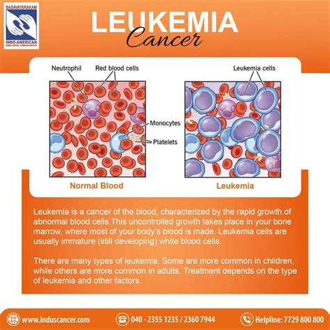Is Low Calcium A Sign Of Leukemia