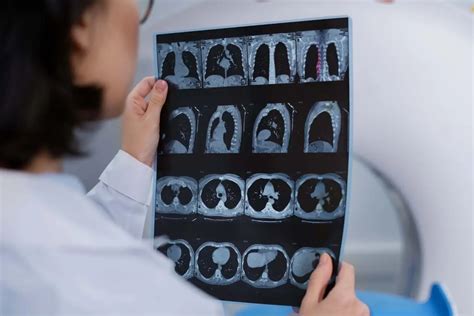 Best Online Teleradiology Reporting Services in India | Vital Radiology ...