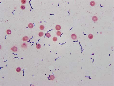 Gram Positive Diplococci