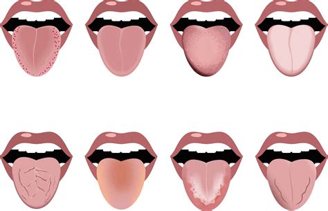 जीभ का रंग बदलना जाने कौन सी बीमारी का है खतरा? - हैलो स्वास्थ्य