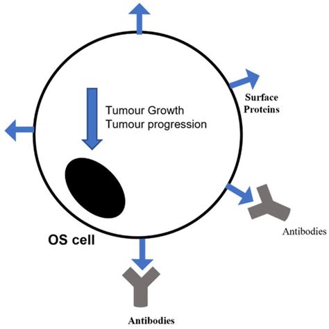 Osteosarcoma in Children: Not Only Chemotherapy