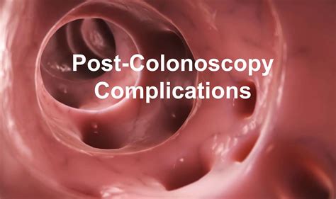 Colonoscopy Risks and Complications: What You Need to Know - Quality ...