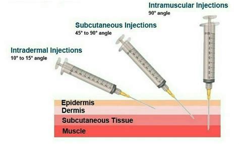 Deep Subcutaneous Injection 的图像结果