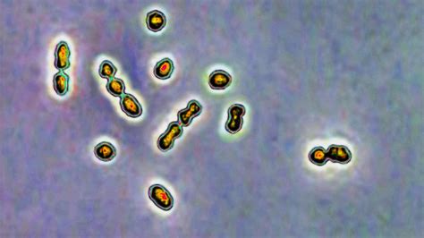 Pfizer Group B strep vaccine for infants returns strong trial results