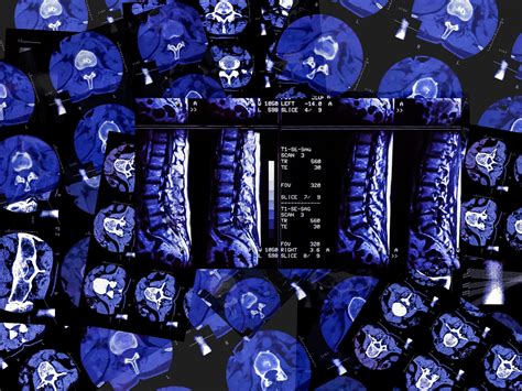 From full-body scans to food allergies, health is now a start-up ...