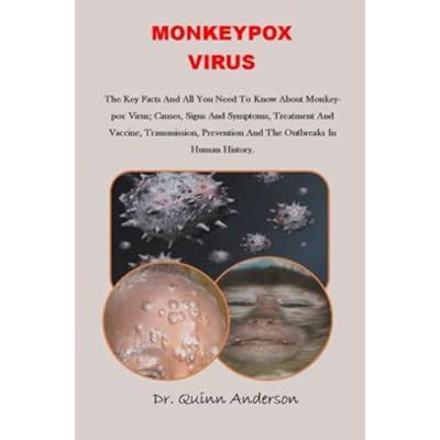 MONKEYPOX VIRUS: The Key Facts And All You Need To | Ubuy India