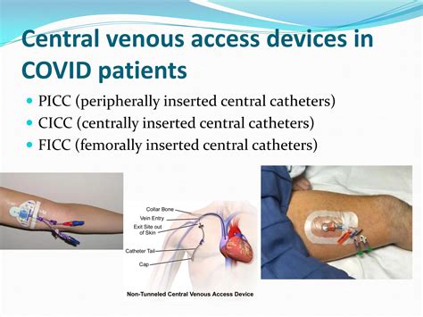 Central-Venous-Catheterization.pdf presentation | PDF