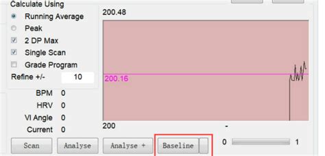 Image result for Spooky2 Sample Digitizer Biofeedback