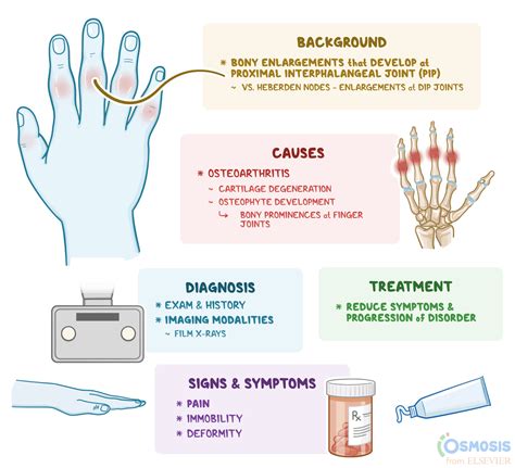 Bouchard Nodes: What Are They, Causes, Signs, Symptoms, and More | Osmosis