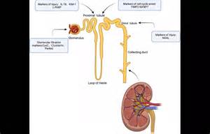 Angiotensinogen as a Predictive Biomarker for AKI and CKD After AMI: Study