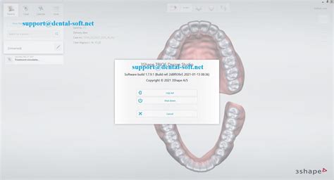 3Shape Design Studio 的图像结果