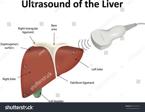 Ultrasound Liver Stock Illustration 301000772 | Shutterstock