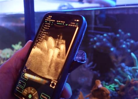 PUM, Looking To The Future. - Portable Ultrasound Machines