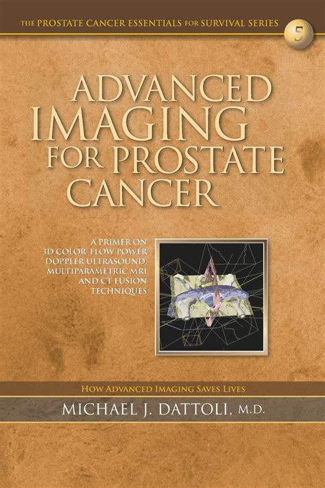 Buy Advanced Imaging for Prostate Cancer: A Primer on 3D Color-Flow ...