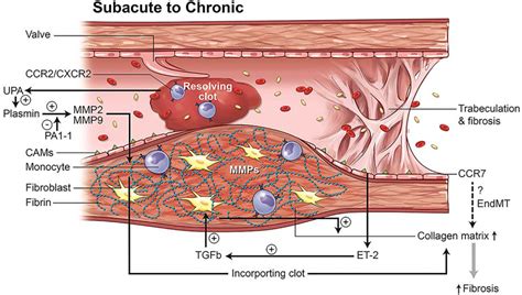 Post Thrombotic Syndrome