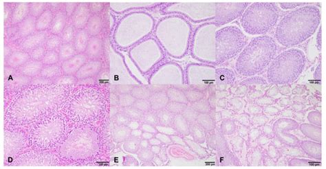 Long-Term Exposure to Isoflavones Alters the Hormonal Steroid ...